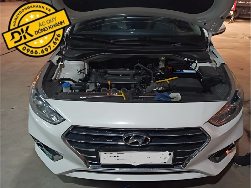 thông số bình ắc quy của xe hyundai accent